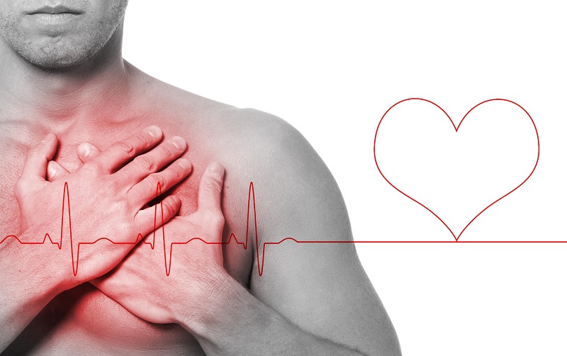 Симптомы ишемической болезни сердца (ИБС)